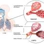 copd_alveolen_dejpg_replacement_image.jpg